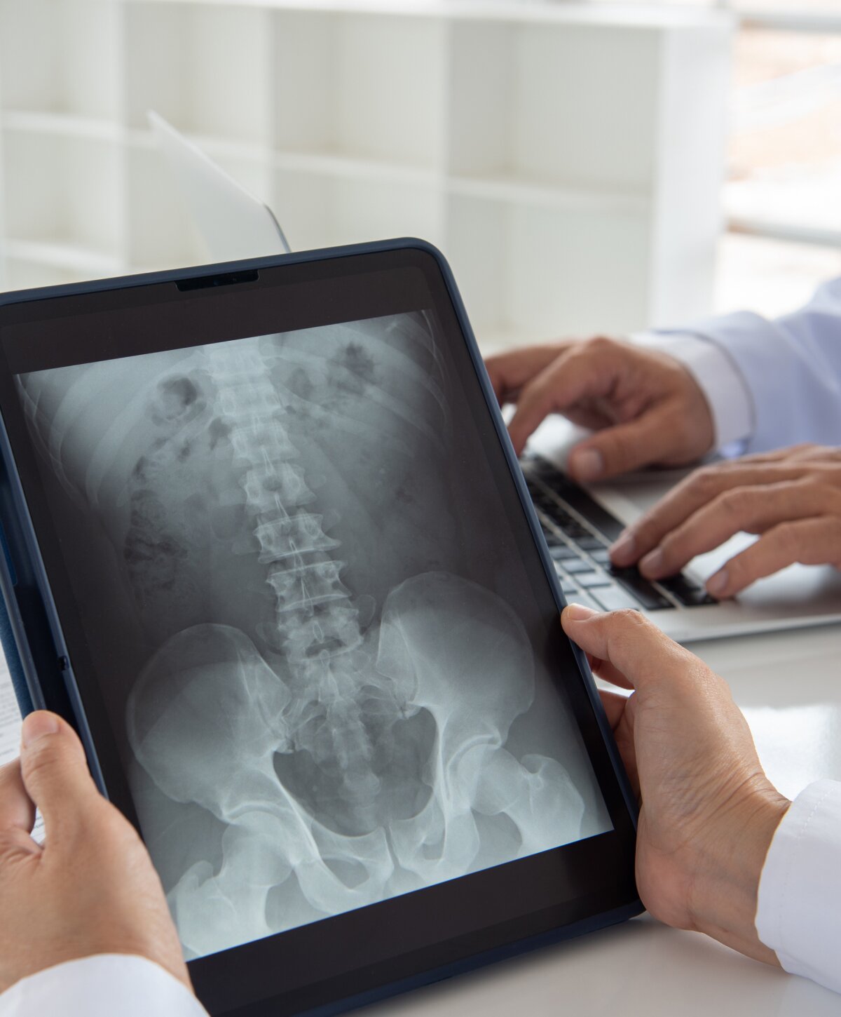Sacramento Outpatient Joint Surgery x-ray 